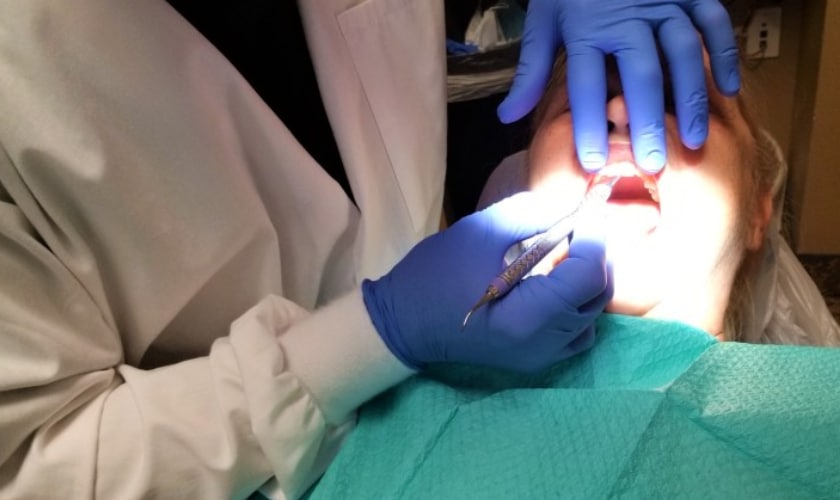 Teeth Cleaning