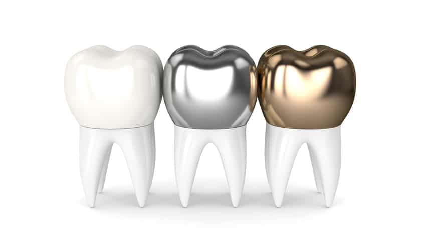 Dental Crown McKinney