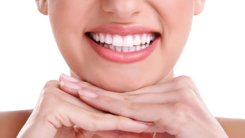 teeth whitening for self-care