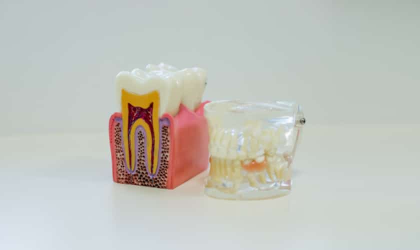 gum_disease_treatment
