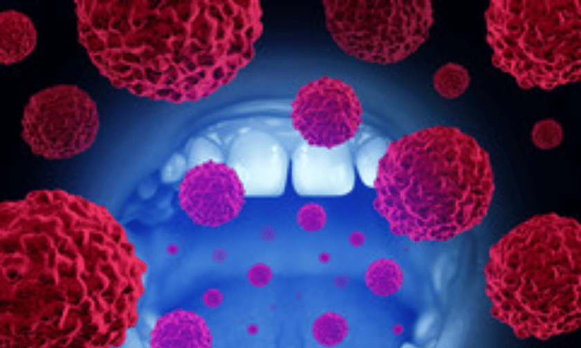 oral cancer prevention Mckinney