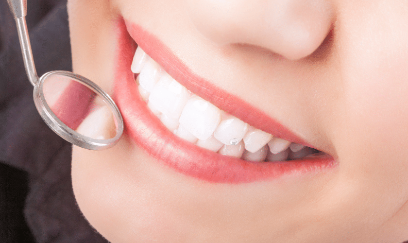 Take A Closer Look At Composite Fillings