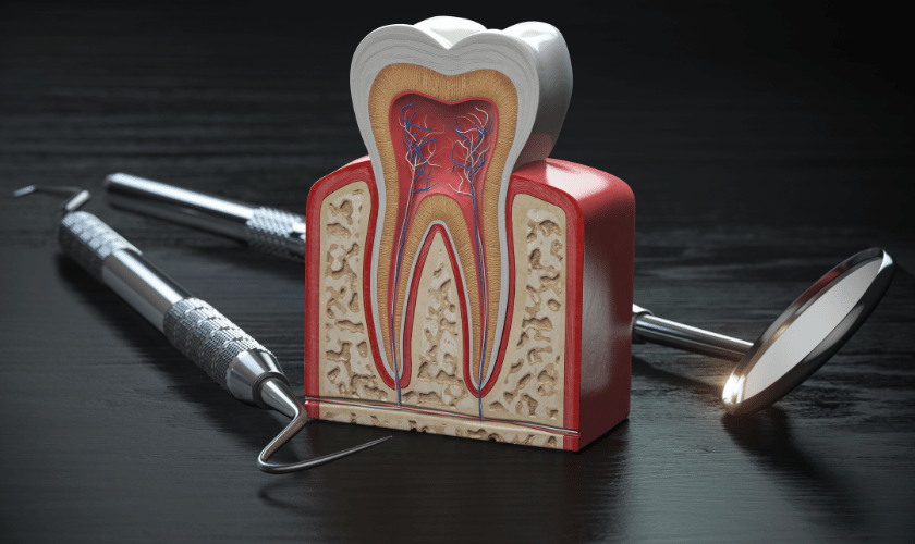 Bone-Grafting-in-Dentistry 2 - Custer Creek Dental Care - Dentist McKinney