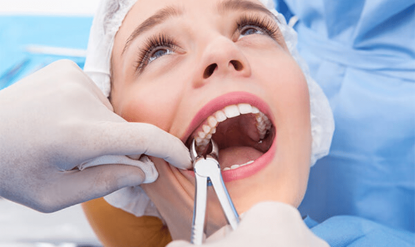 How Do You Maintain Oral Hygiene After Tooth Extraction