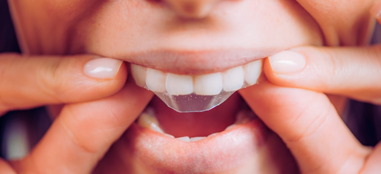 is it okay to brush after applying whitening strips